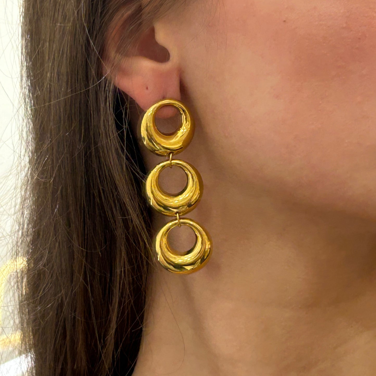 Pendiente Dismetría